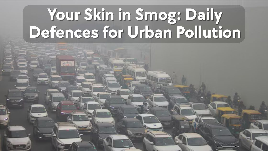 Your Skin in Smog
